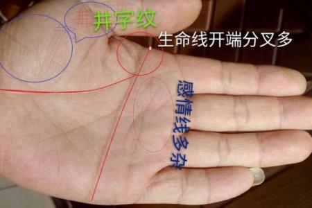 去痣命理大揭秘：能改运吗？合婚看什么？你的命运会因此不同吗？