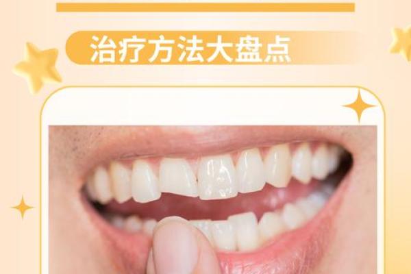解析牙齿外伤命理：牙齿问题是否意味着命运不同？